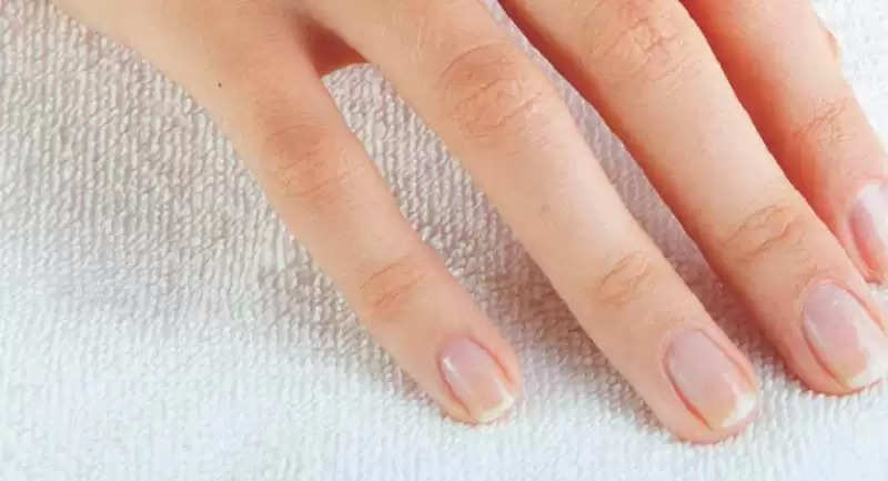White Spots on the Nails: Causes, Prevention and More | Astrovaidya