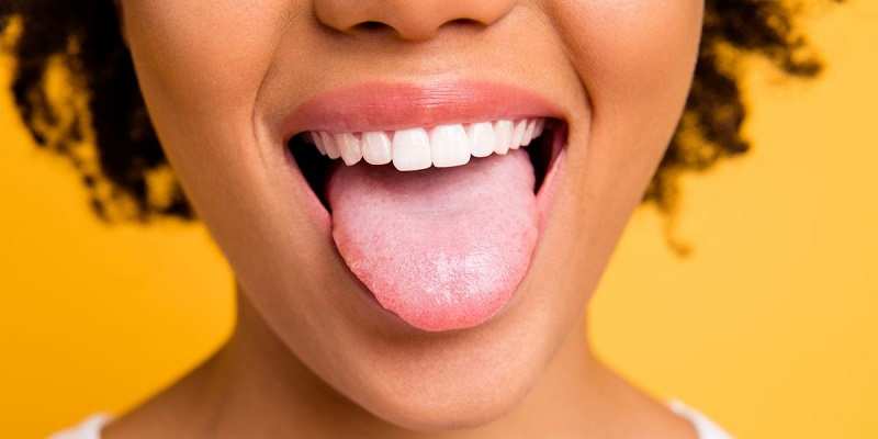 Health Tips: These Symptoms Appearing On The Tongue Are A Sign Of ...